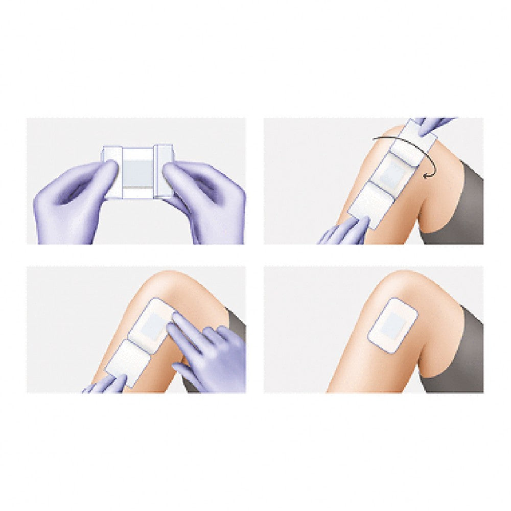 Hartmann Cosmopor Advance Sterile自黏性敷料適用於手術後傷口治療和輕傷的消毒護理，如急救等，尤其適用於有大量滲液的手術後一級癒合傷口，更大吸收量，能有效避免滲液反滲或漏出。運用了 Dry Barrier® 的技術，使傷口滲液快速傳遞到吸收層，並將其有效鎖定，即使在受外力擠壓的情況下亦能避免反滲或漏出，使用了柔軟無紡布為背面材料，附帶高吸水性內墊，高吸水性和低反滲，敷料能持久貼合於手術後傷口，傷口接觸層由細孔聚乙烯 (polyethylene) 網紗製成，能有效避免敷墊與傷口。